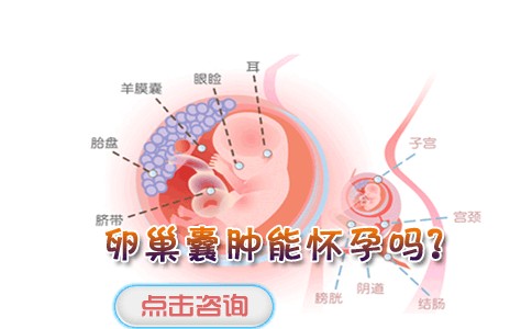 卵巢囊肿